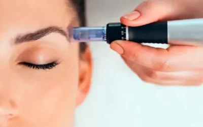 Dermapen: Tecnología de precisión para una piel visiblemente rejuvenecida