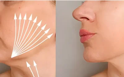 Dermapen: Tecnología de precisión para una piel visiblemente renovada